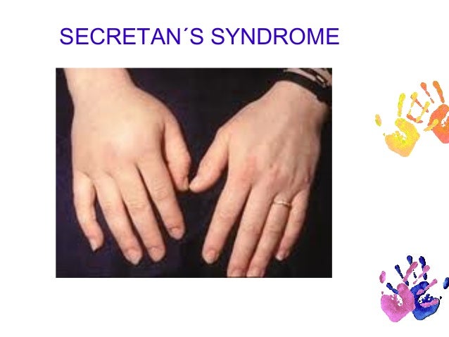 Secretan's Syndrome