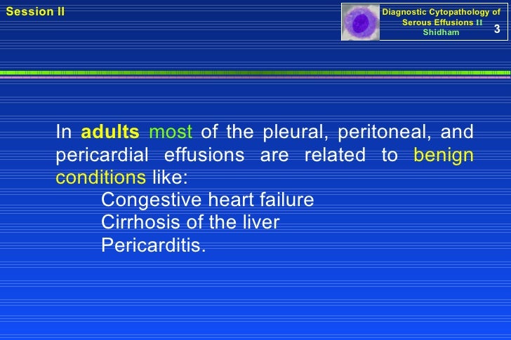 nivolumab mesothelioma united kingdom