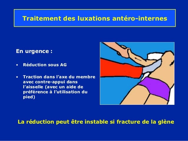 Si les filles il y avait chez vous un petit membre et comme