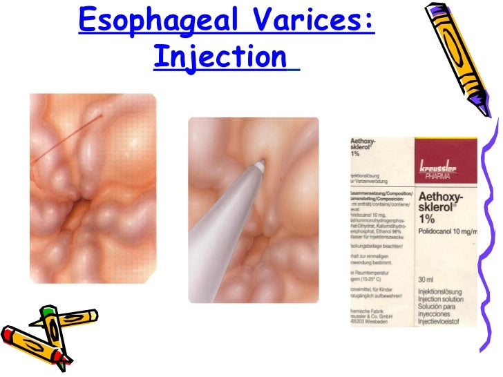 TAEM10Roles of endoscopic nurse