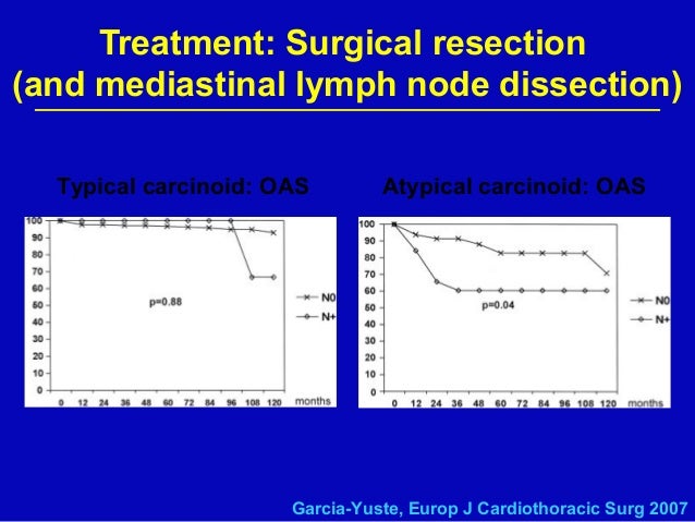 peritoneal mesothelioma mimicking