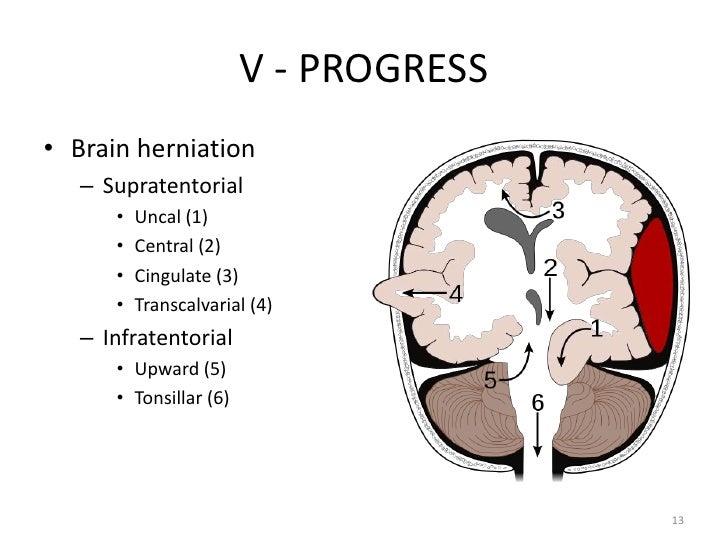 cerebral palsy types