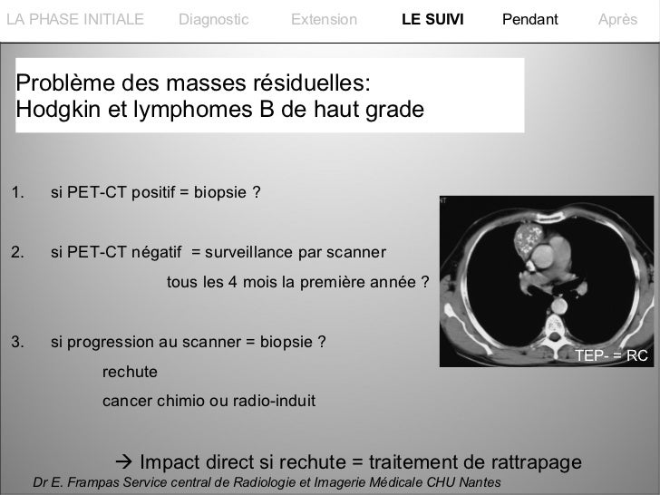 symptome most cancers du poumon phase terminale