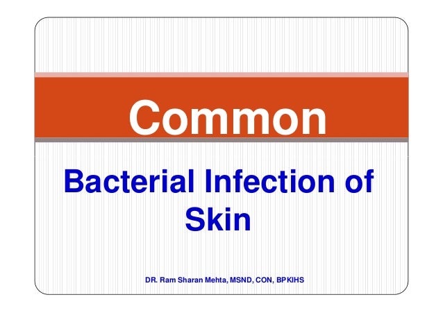 ... Infection of Skin DR. Ram Sharan Mehta, MSND, CON, BPKIHS ... Infection of Skin DR. Ram Sharan Mehta, MSND, CON, BPKIHS