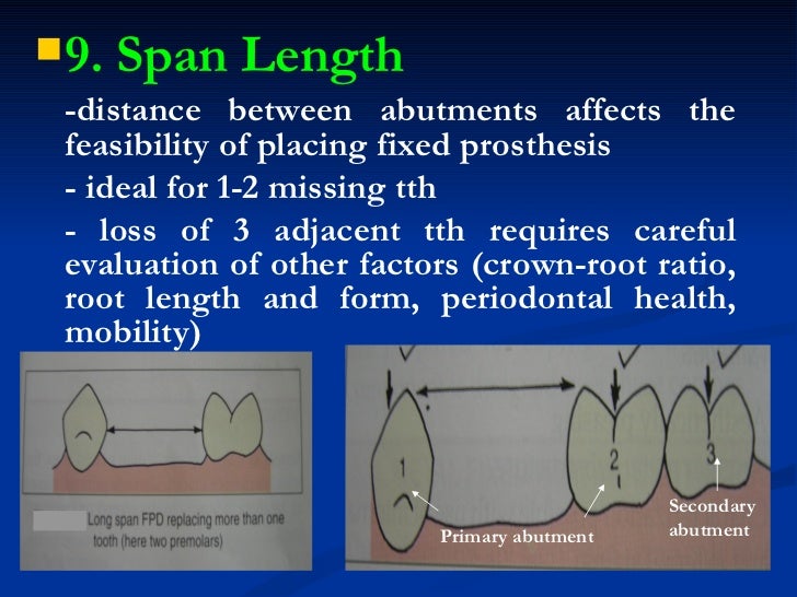 1. fixed partial denture finals1