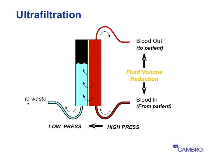 1 prismaflex crrt intro seg 1 (2007)