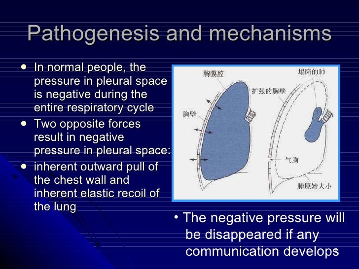 10.Pneumothorax