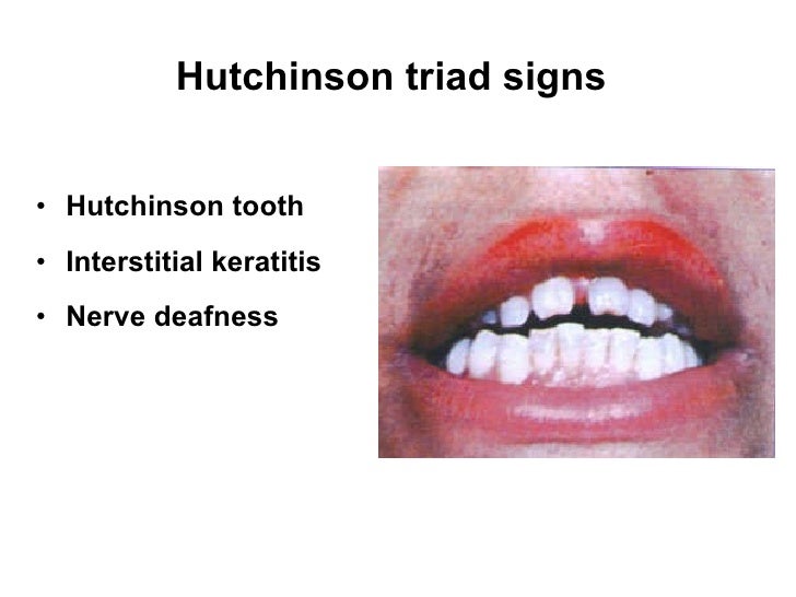 10 pregnancy with sexual transmitted disease