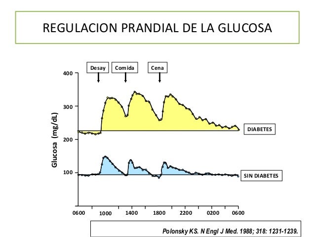 Vaciamiento gástrico e hiperglucemia postprandial Vaciamiento gástrico e hiperglucemia postprandial