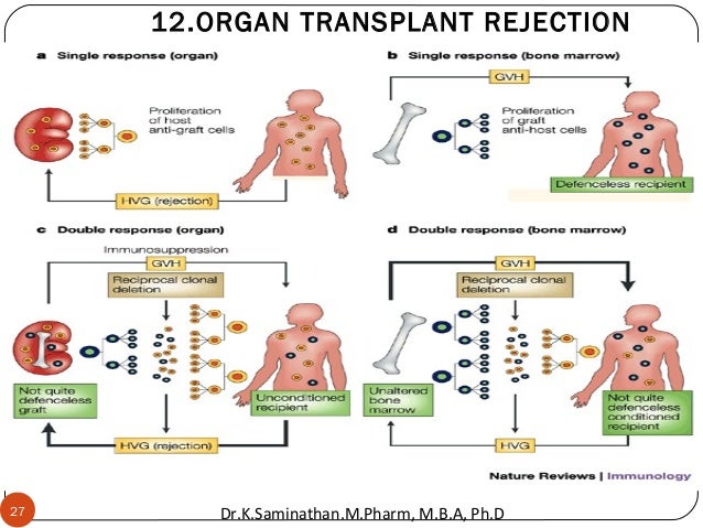 11 immunosuppressants organ rejection