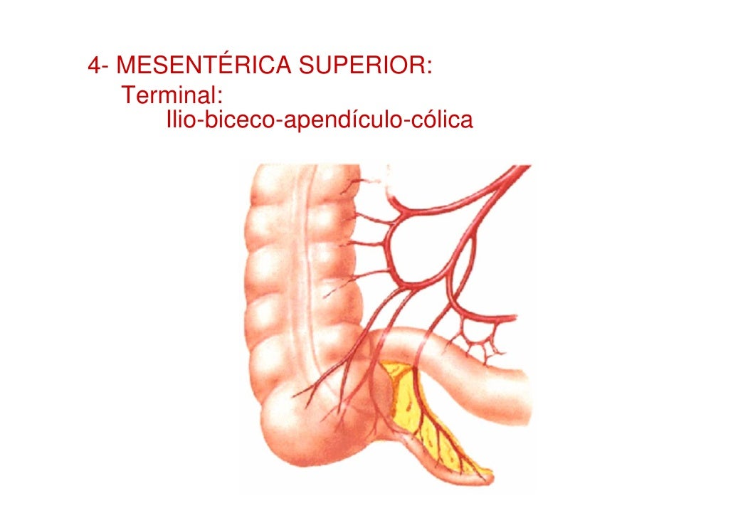 Cáncer De Colon Etapa 4 Es Terminal