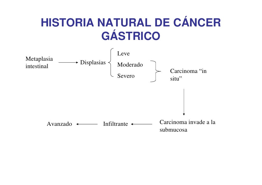 Cancer Gastrico Sintomas Y Signos | cancer gastrico Cancer Gastrico Sintomas Y Signos | cancer gastrico