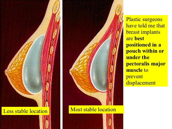 12 Appendicular Muscles