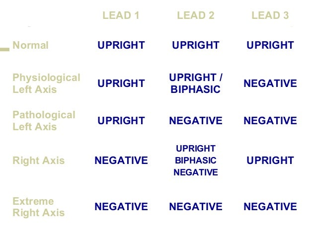 Introduction To 12-Lead ECG: The Art Of Interpretation, Garcia, Tomas B. Book Introduction To 12-Lead ECG: The Art Of Interpretation, Garcia, Tomas B. Book