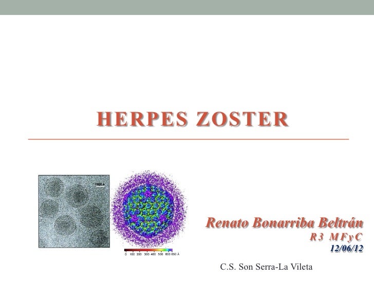 Neuropatia Por Herpes Zoster Pdf