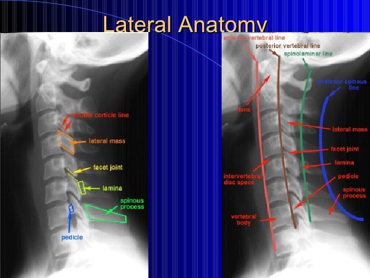 125 Week 11 Cervical Spine