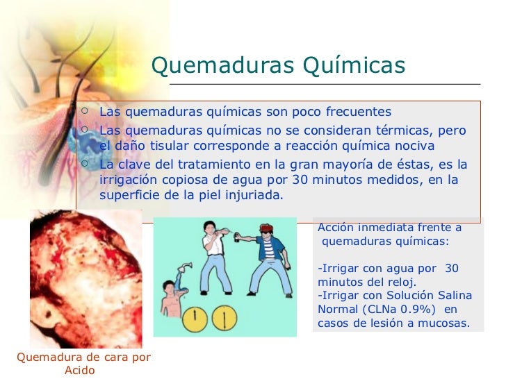 13 Manejode Quemados[1]