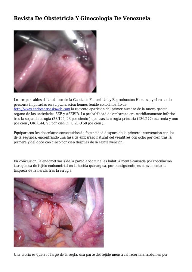 GINECOLOGIA REVISTA ginecologia revista: