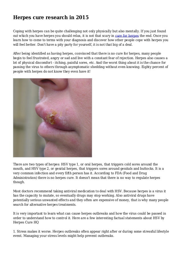 Herpes - Natural Treatments Chickenpox