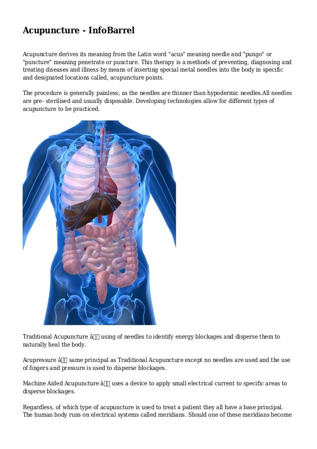 Acupuncture InfoBarrel