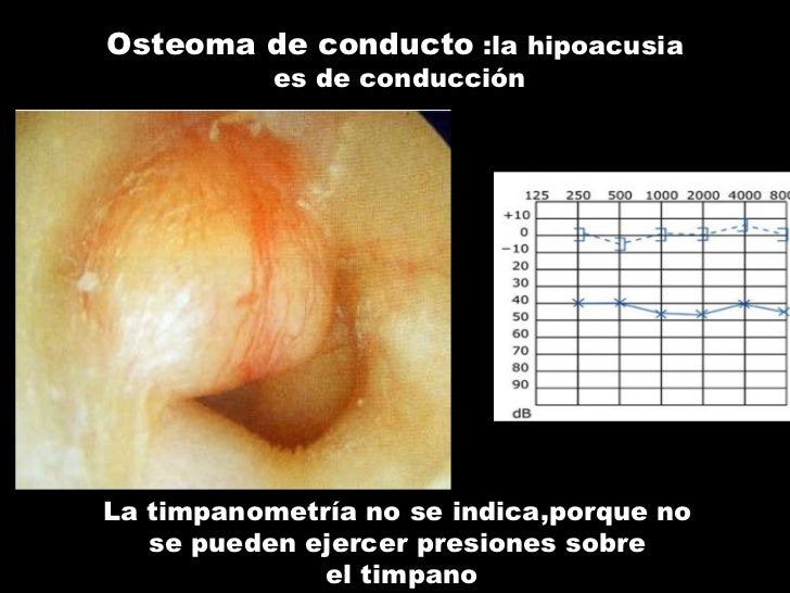 Casos Clinicos Otitis casos-clinicos-otitis