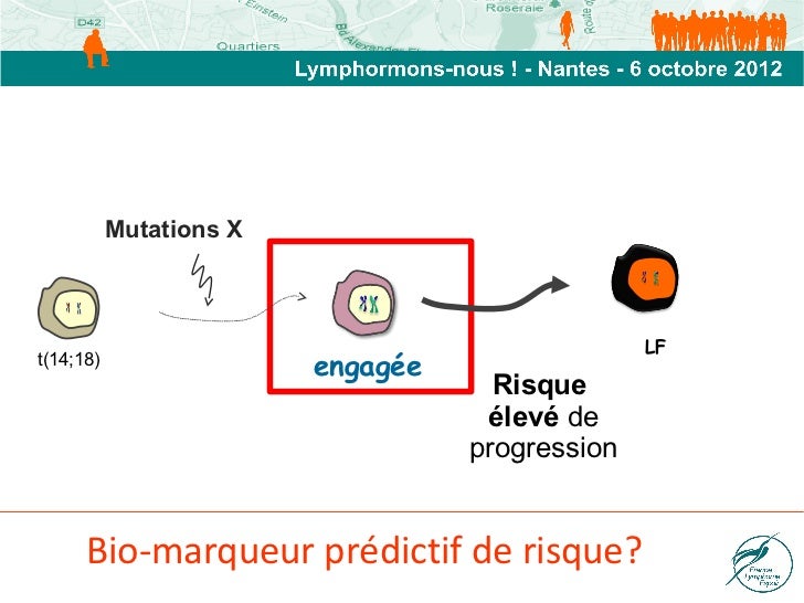 Most cancers Du Sang Ganglion