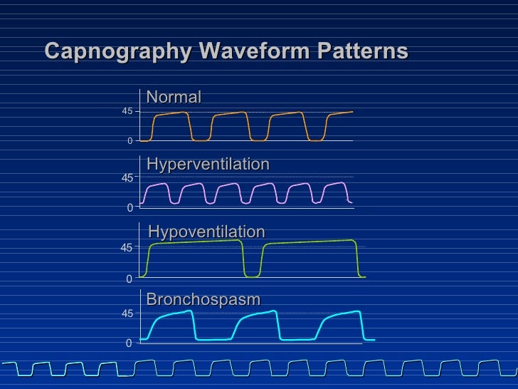 15 Capnography Part2 Introduction 15 Capnography Part2 Introduction