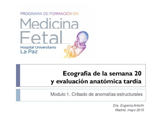 ECOGRAFIA DE LA SEMANA 20 ecografia de la semana 20:
