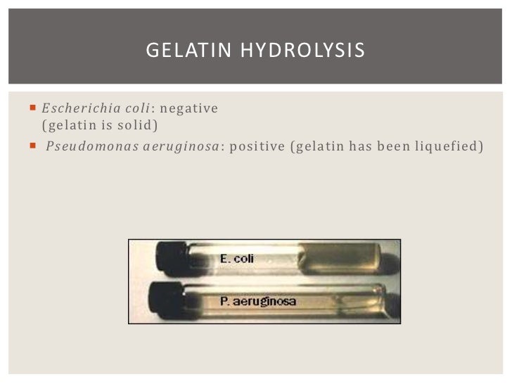 gelatin hydrolysis test e coli gelatin hydrolysis test e coli