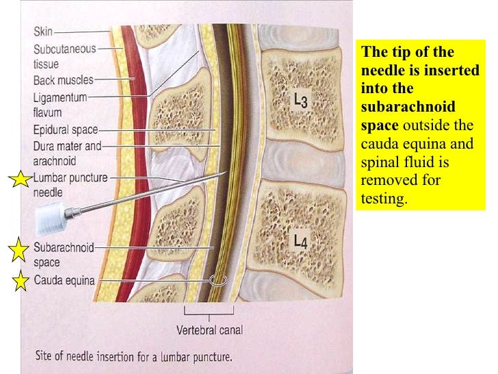 16 Spinal Cord And Spinal Nerves