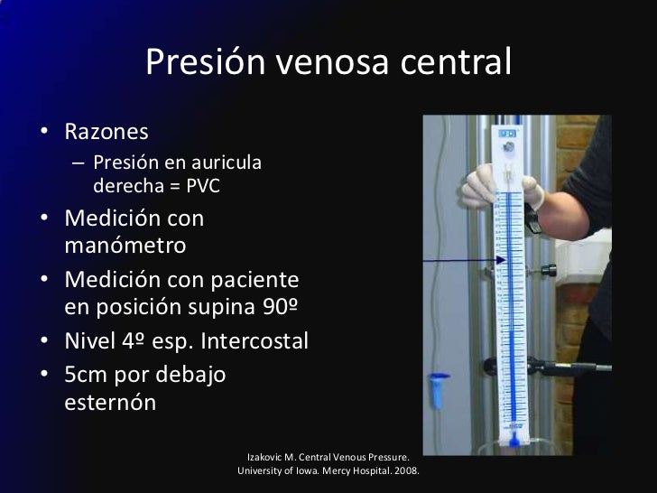 Cateterizacion Venosa Central