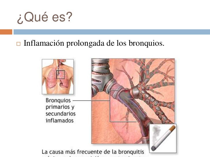 El humor bueno que ha dejado fumar