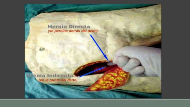 kidney transplant repute icd 10