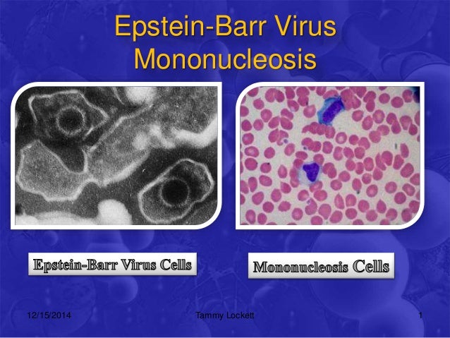 the cause of mononucleosis the epstein barr virus Infectious mononucleosis is a viral disease that affects certain blood cells it is caused by the epstein-barr virus (ebv), which is a member of the herpesvirus. the cause of mononucleosis the epstein barr virus Infectious mononucleosis is a viral disease that affects certain blood cells it is caused by the epstein-barr virus (ebv), which is a member of the herpesvirus.