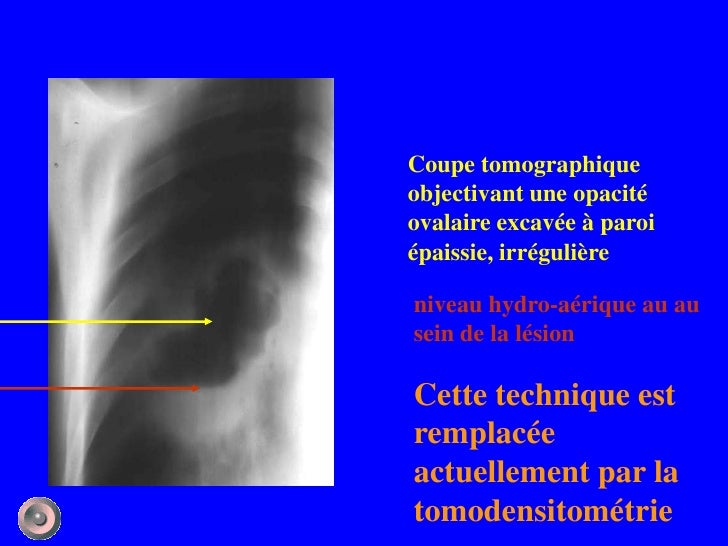 1 anatomie et semiologie rdiologique (version 4)