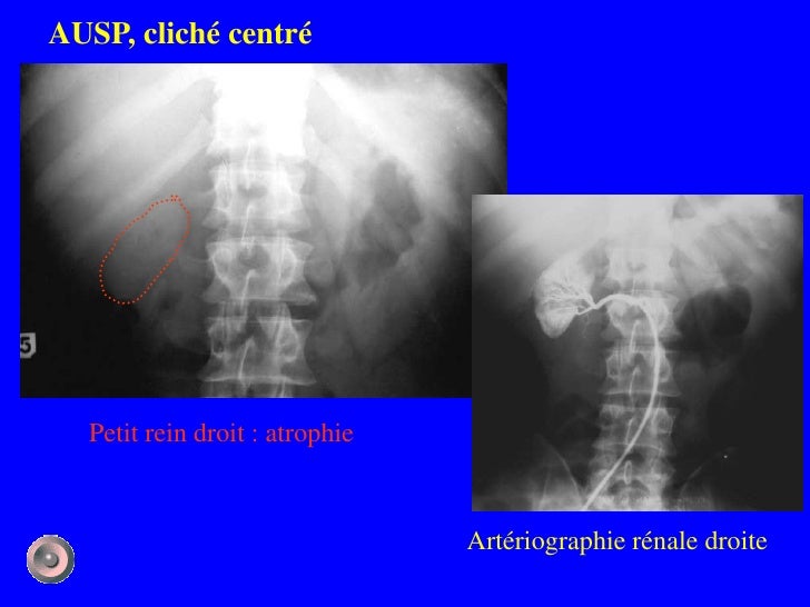1 anatomie et semiologie rdiologique (version 4)