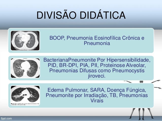 boop pneumonia survival rate