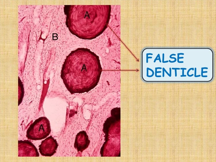 1 enamel dentin pulp