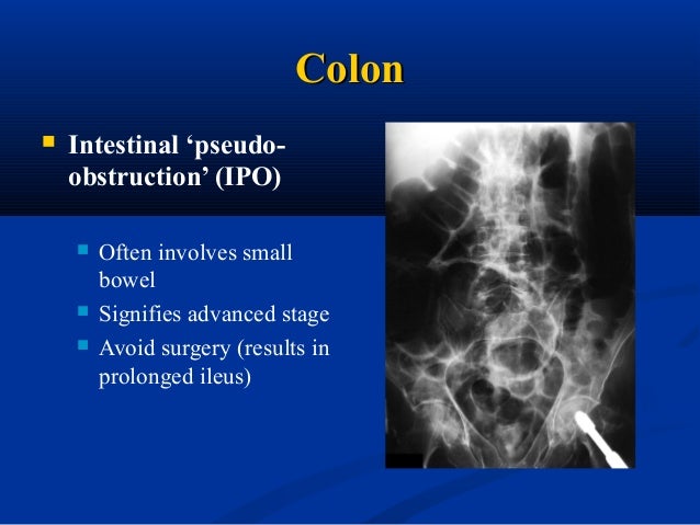 Common Drugs and Medications to Treat Urinary Tract Infection Ciprofloxacine Infection bact rienne Commander en ligne
