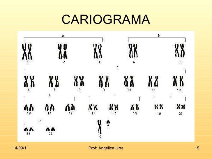 Resultado de imagen para cariograma