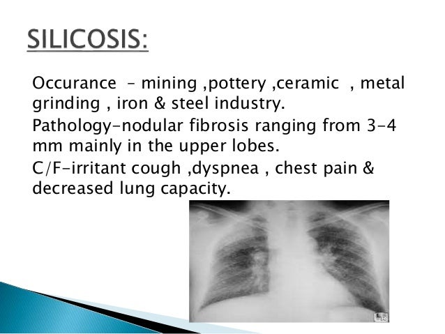 asbestosis how long after exposure