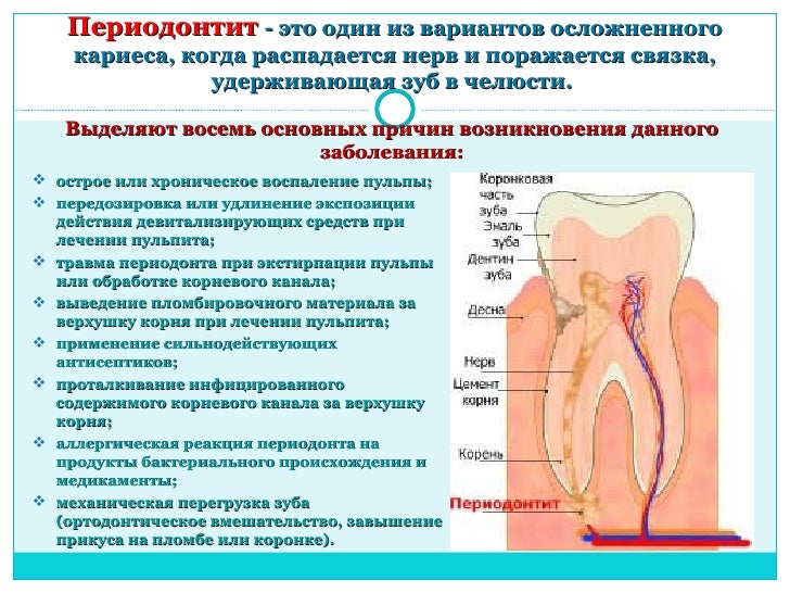 Почему больно при лечении зуба Почему больно при лечении зуба