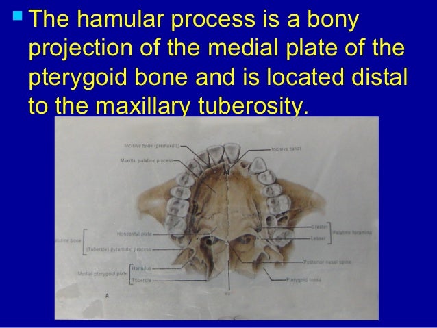 anatomy hamular notch