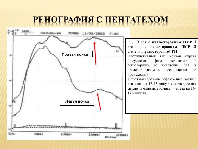 Как лечить дислалию у детей
