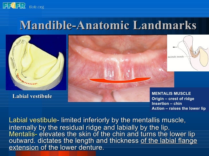 2.anatomy of the denture foundation areas