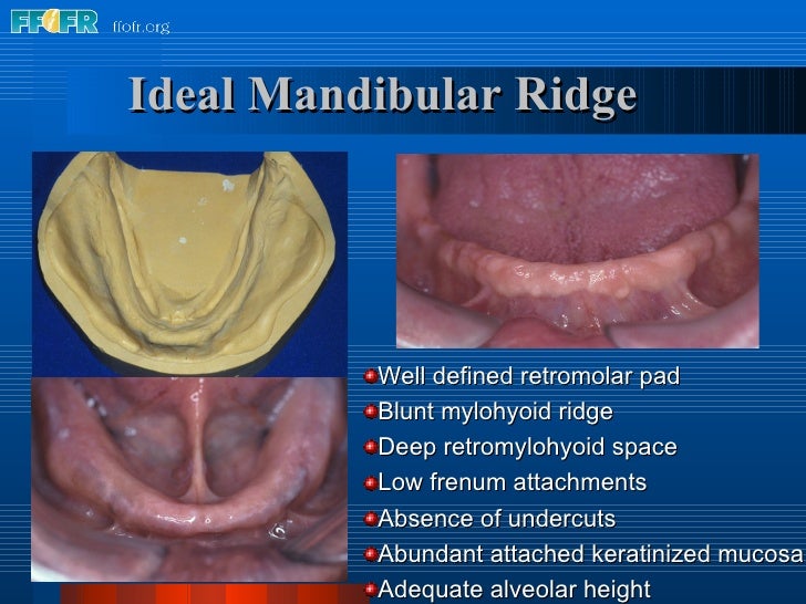 2.anatomy of the denture foundation areas