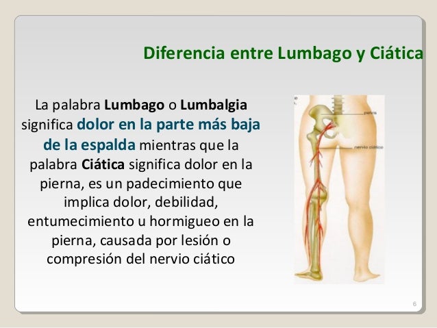Los síndromes a sheynom la osteocondrosis