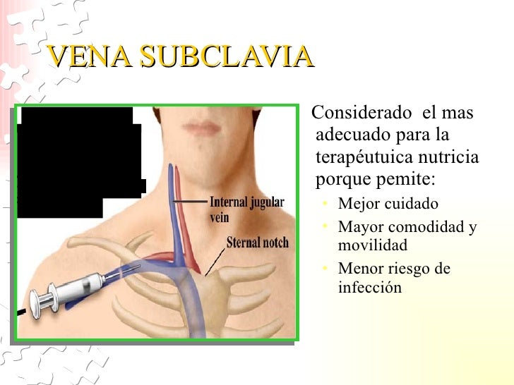 20. cuidado del paciente con nutricion enteral y parenteral lobitofer… 20. cuidado del paciente con nutricion enteral y parenteral lobitofer…
