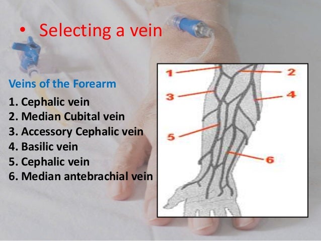 20 Iv Cannulation 20 Iv Cannulation