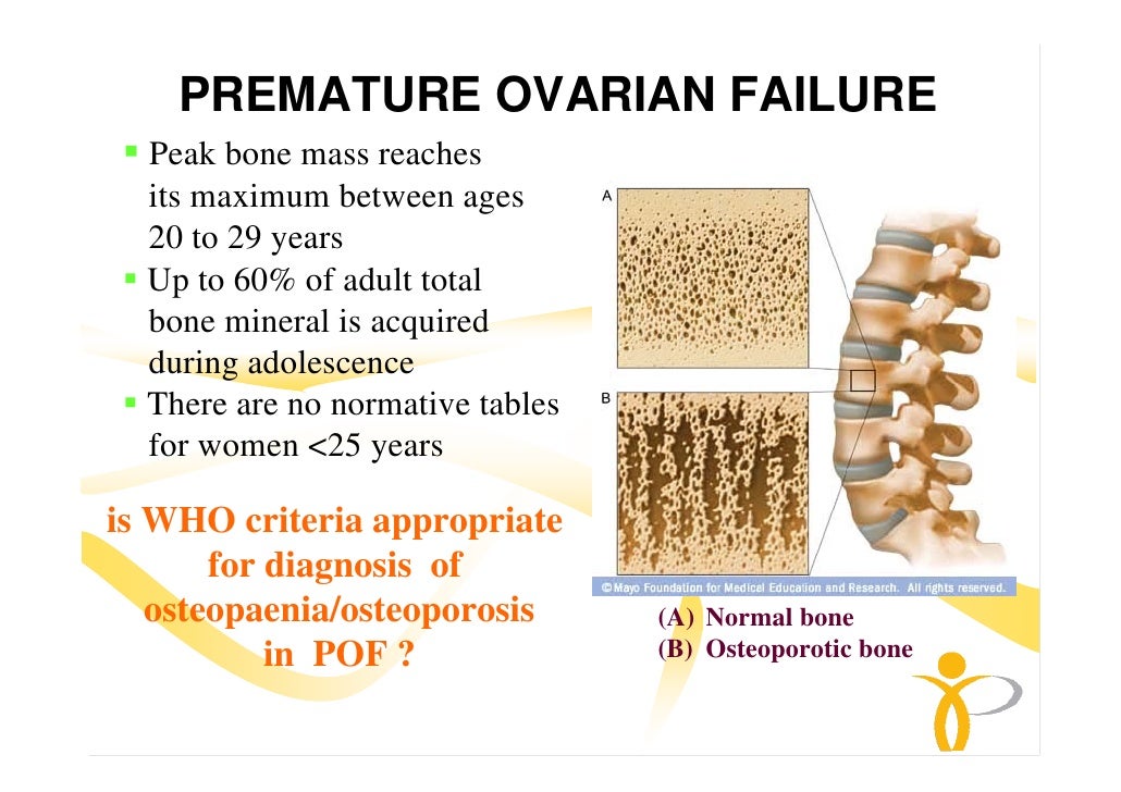 Prevention of Osteoporosis in early menopause